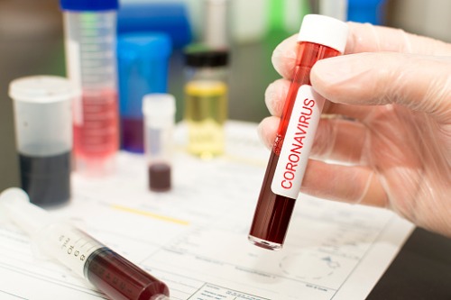 Coronavirus to inflict US$320 billion in trade losses each quarter – Allianz